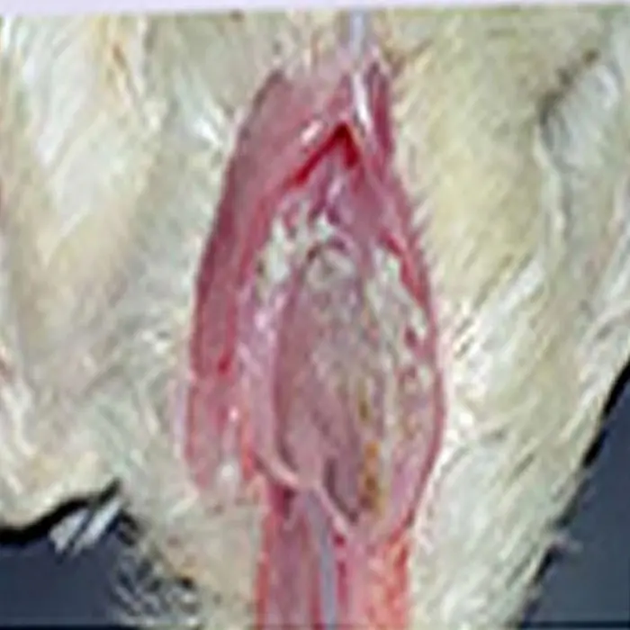 candidiasis en aves - Cómo borrar la candidiasis