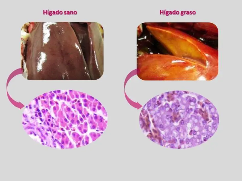 El hígado de las aves: una fuente nutricional y saludable - Cómo es el hígado de las aves higado de ave - Cómo es el hígado de las aves